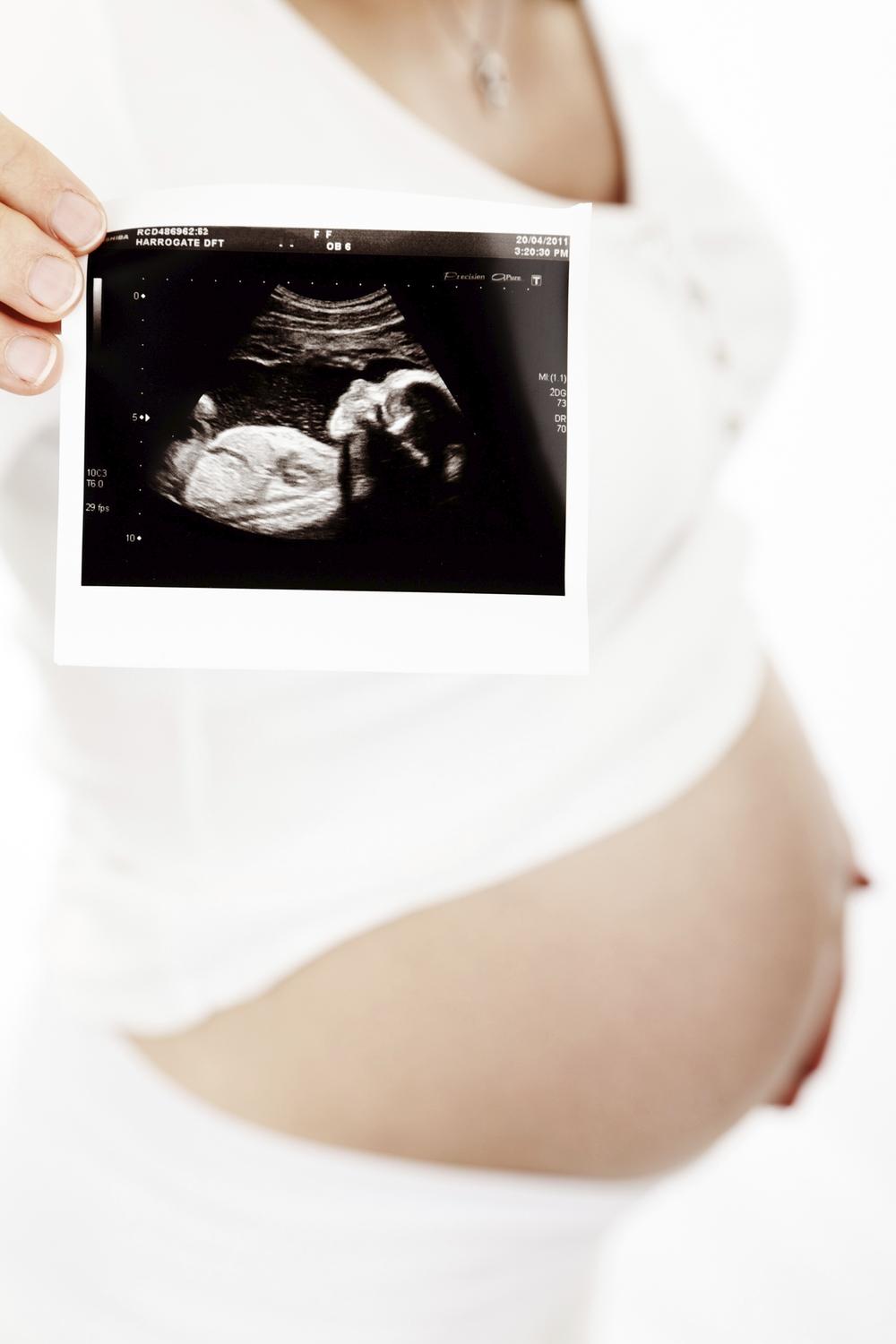 How Fetal Ultrasound Support Can Enhance Home Birth&nbsp;Midwifery
